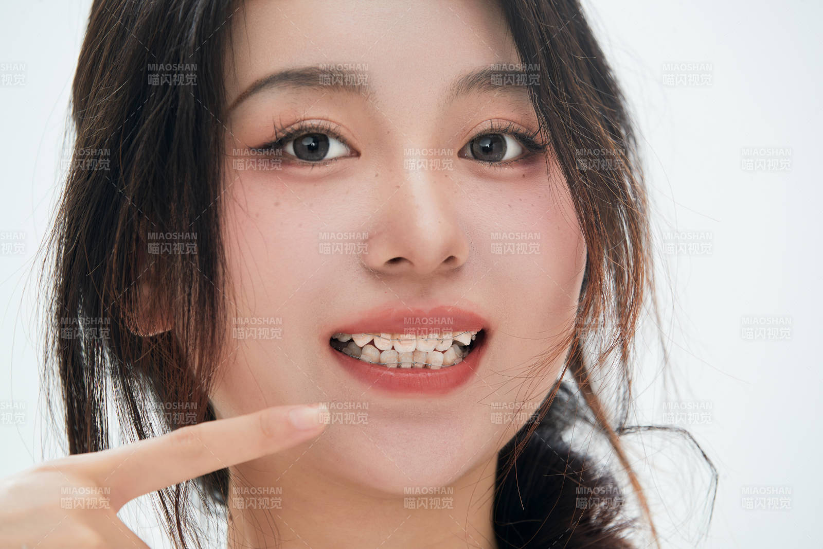 佩戴牙齒矯正器的亞洲美女牙齒矯正牙科