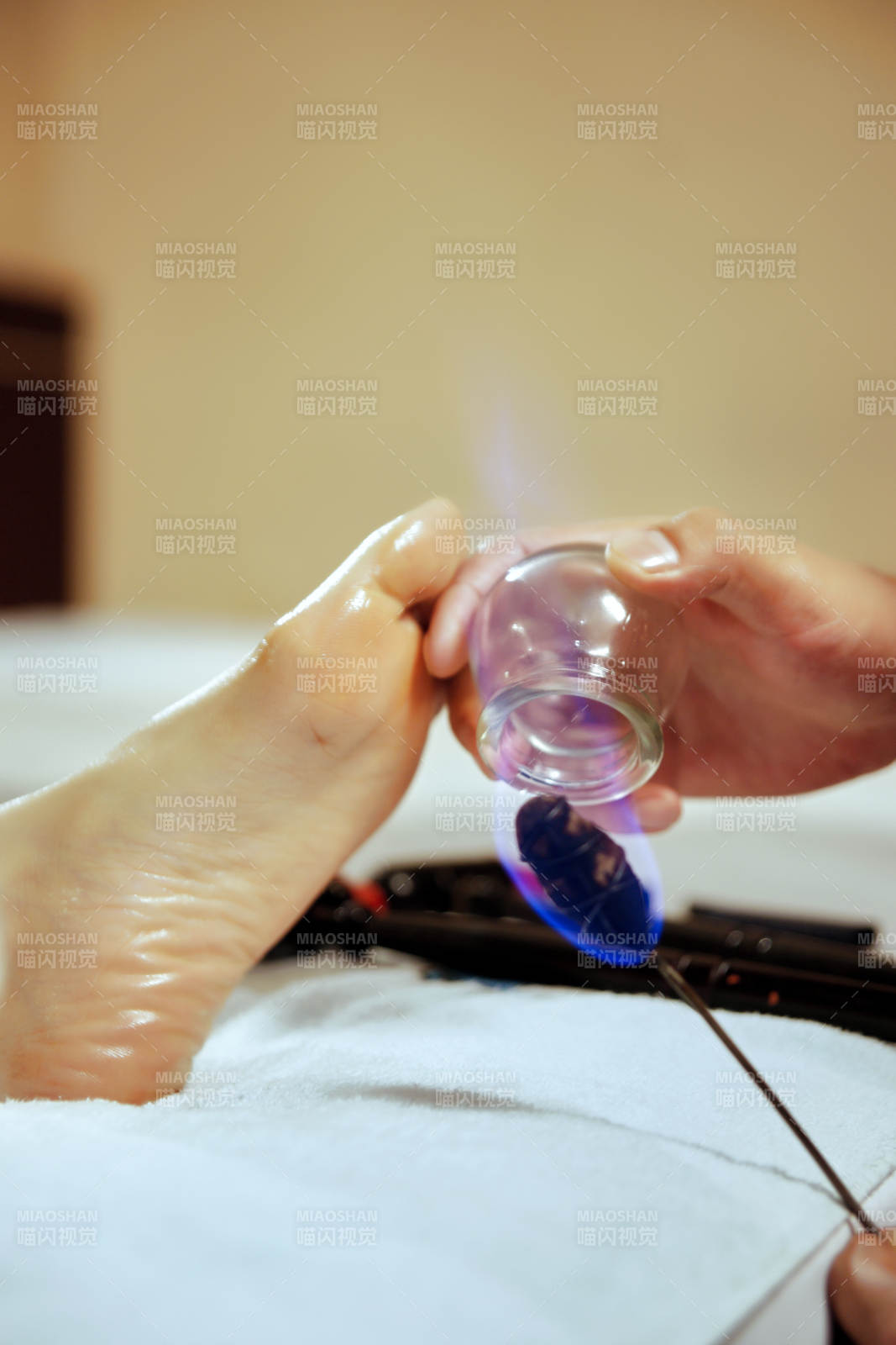 專業的足療技師為顧客做足底火罐