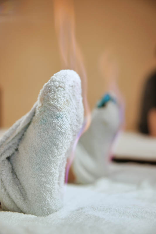 专业的足疗技师为顾客做足底火罐