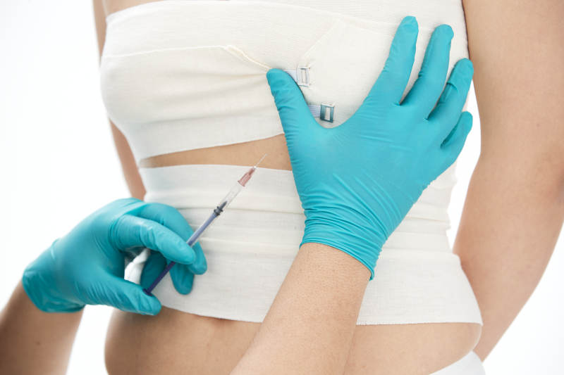 醫療美容身體整形注射及檢查