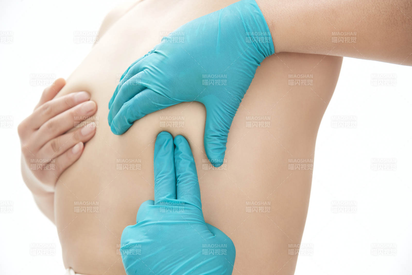 醫學美容身體整形手術前軀干上的螞蟻線