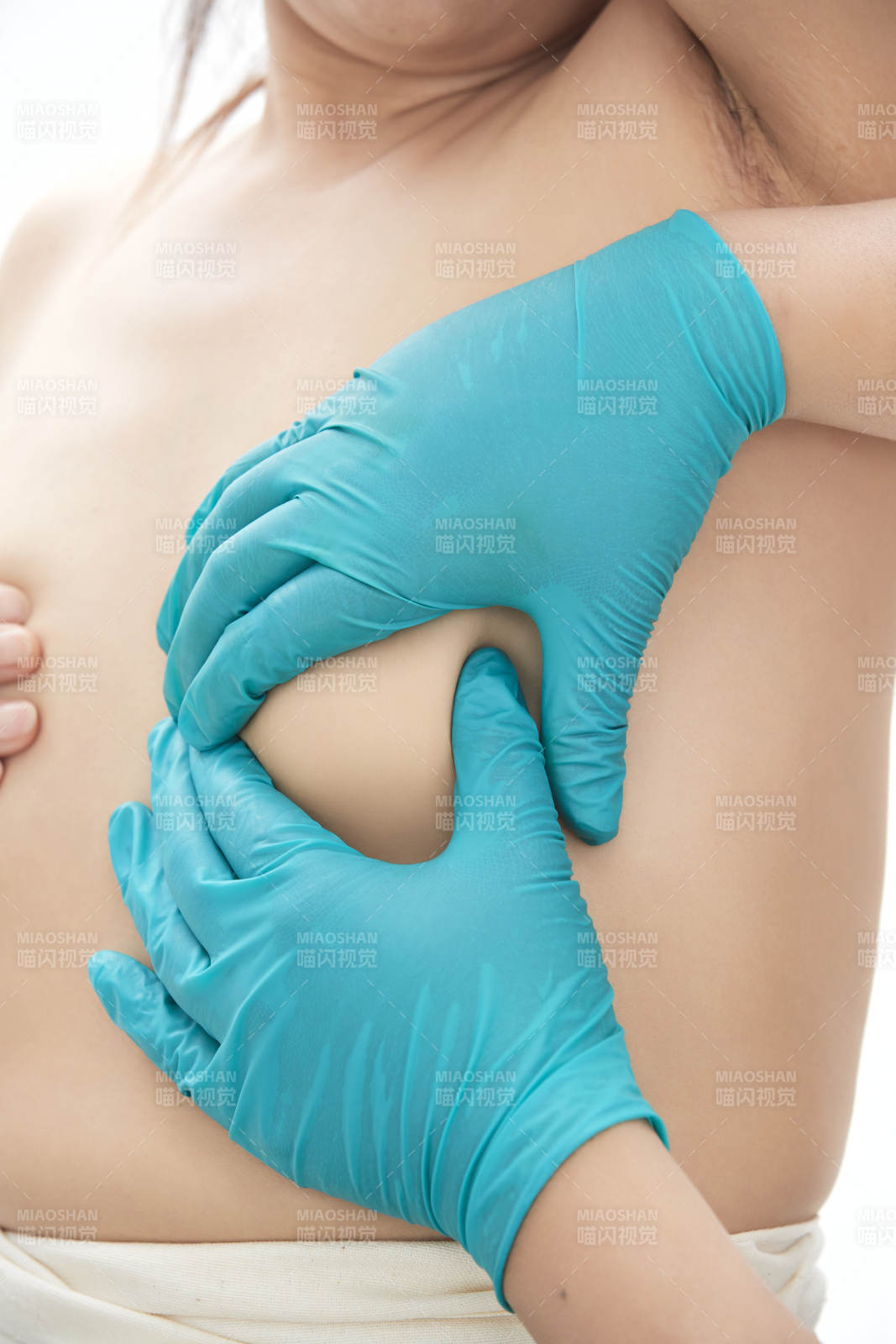 医学美容身体整形手术前躯干上的蚂蚁线