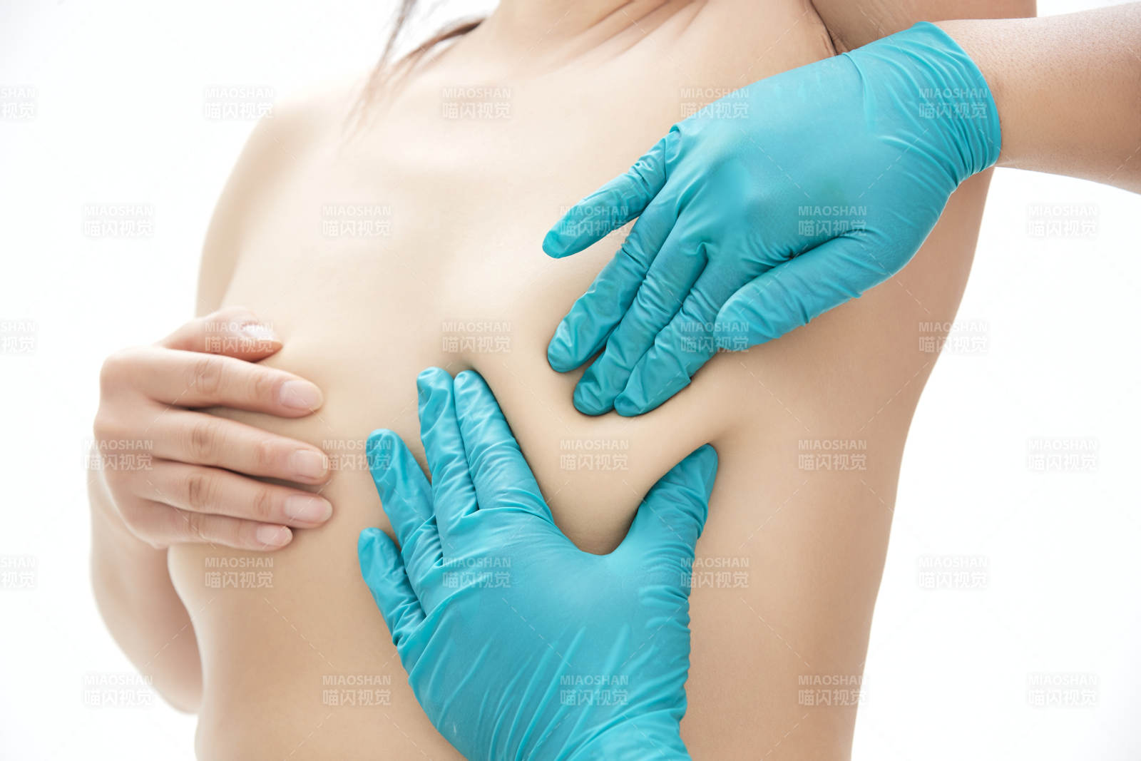 醫學美容身體整形手術前軀干上的螞蟻線