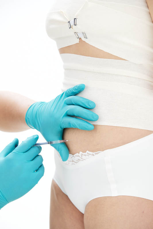 医疗美容身体整形注射及检查