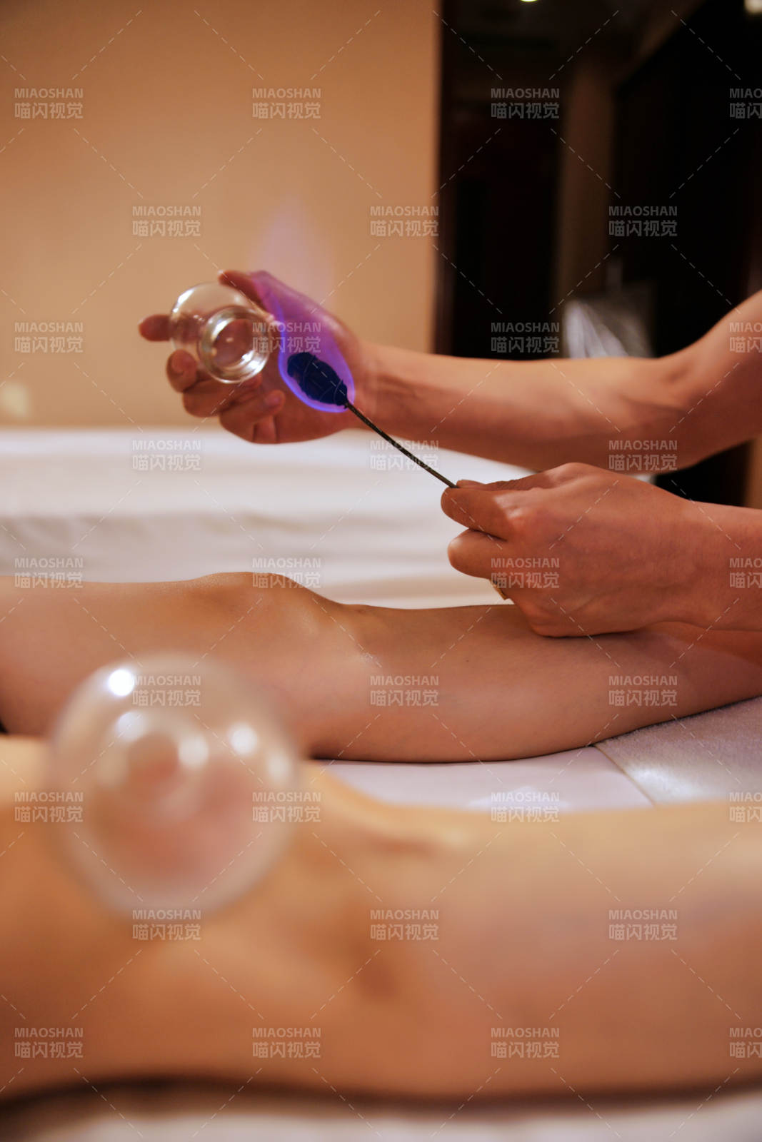 專業的保健技師為顧客進行吸筒療法拔火罐