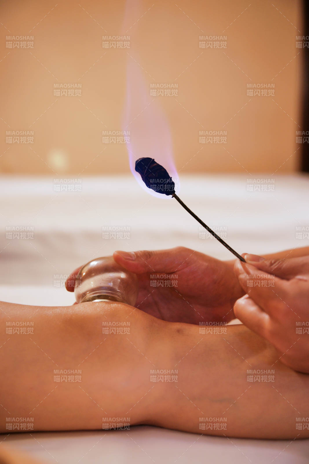 專業(yè)的保健技師為顧客進(jìn)行吸筒療法拔火罐