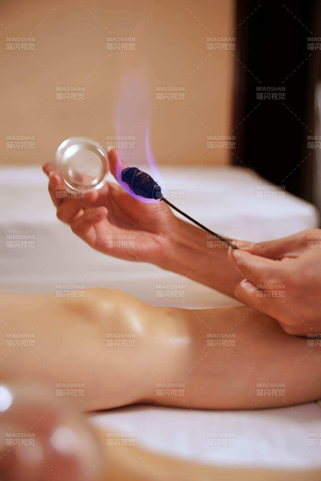 專業的保健技師為顧客進行吸筒療法拔火罐