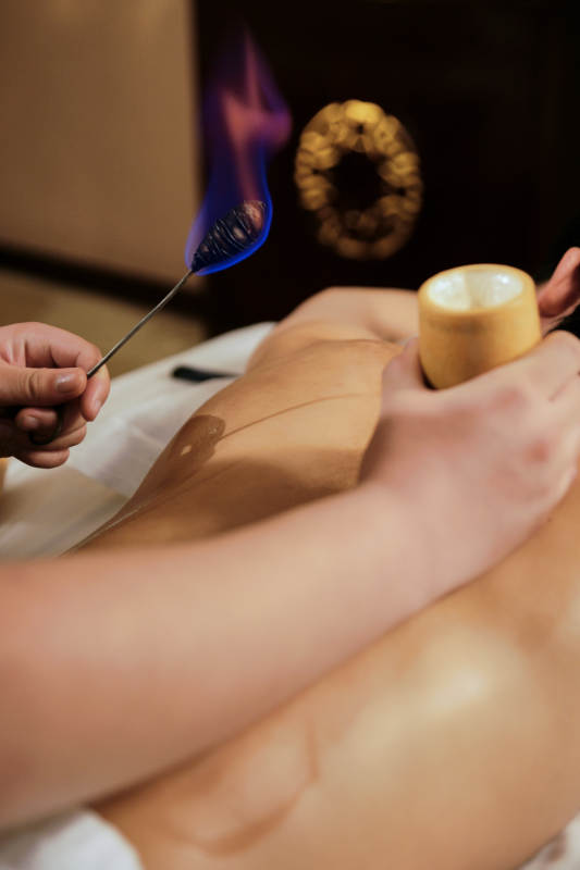 专业的保健技师为顾客进行吸筒疗法拔火罐