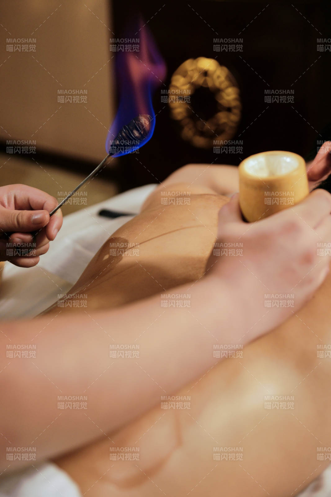 專業(yè)的保健技師為顧客進行吸筒療法拔火罐