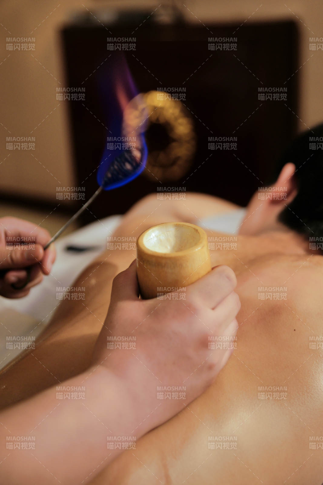 專業的保健技師為顧客進行吸筒療法拔火罐