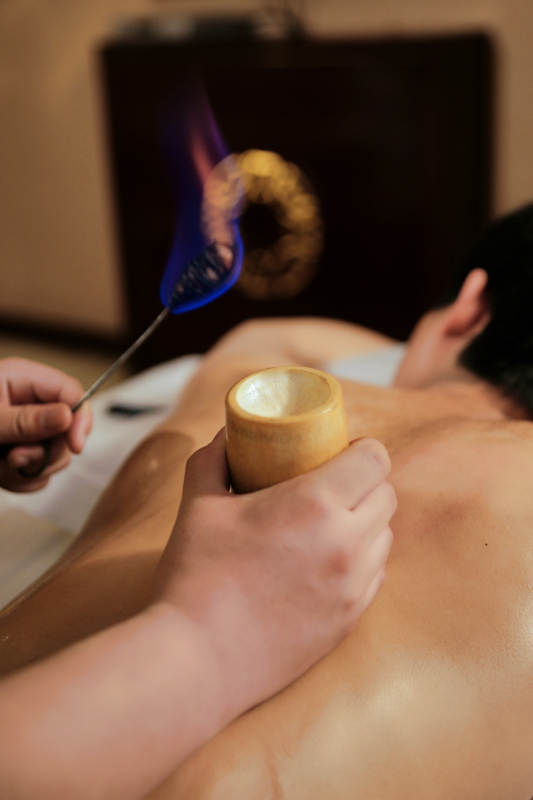 专业的保健技师为顾客进行吸筒疗法拔火罐