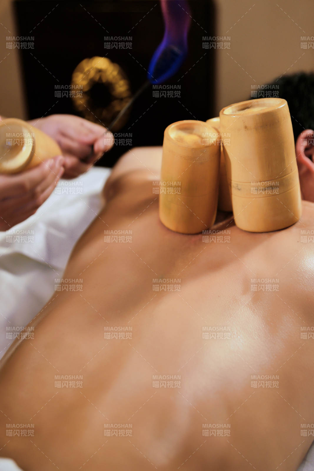專業(yè)的保健技師為顧客進(jìn)行吸筒療法拔火罐