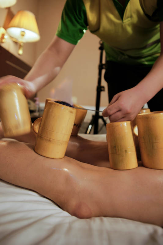 专业的保健技师为顾客进行吸筒疗法拔火罐