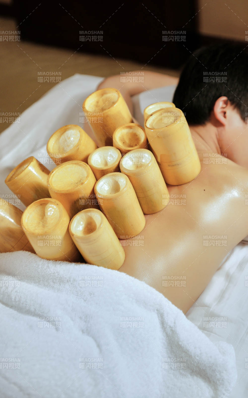 专业的保健技师为顾客进行吸筒疗法拔火罐