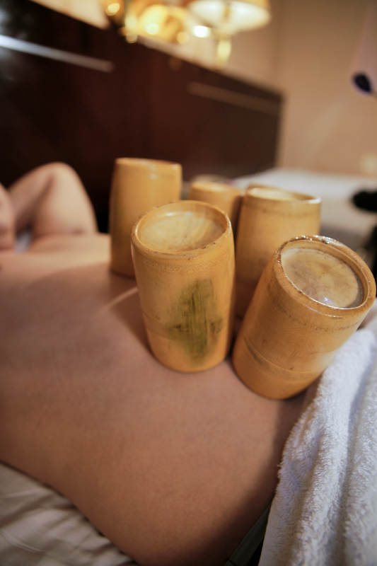 专业的保健技师为顾客进行吸筒疗法拔火罐