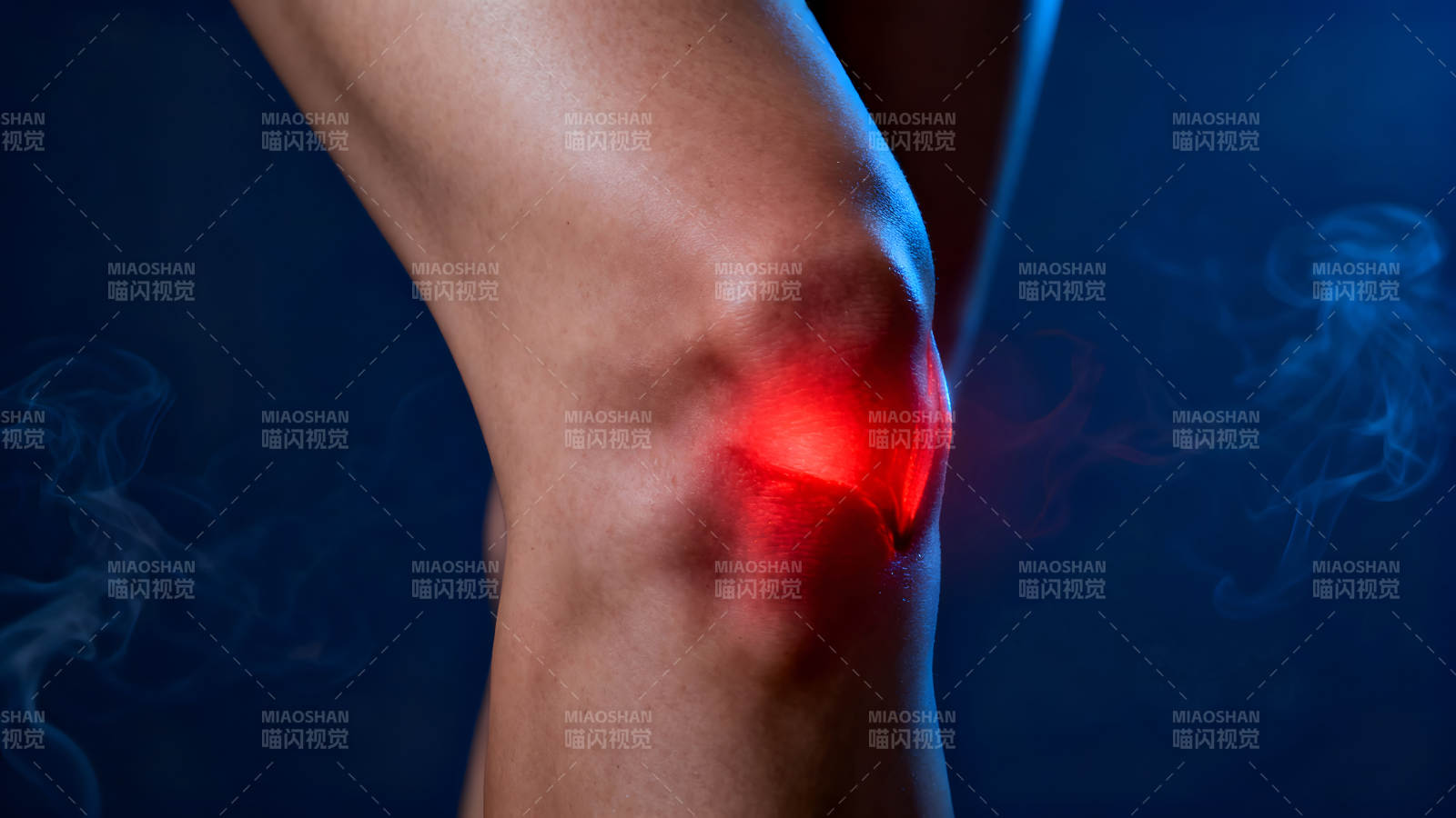 膝盖红肿发炎关节疼痛症状明显-图片