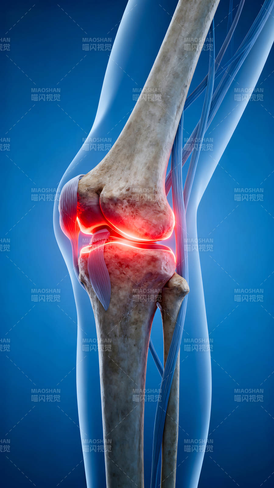 膝关节结构图示疼痛部位发红-图片