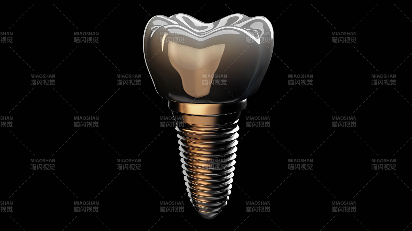 牙科种植体模型图片