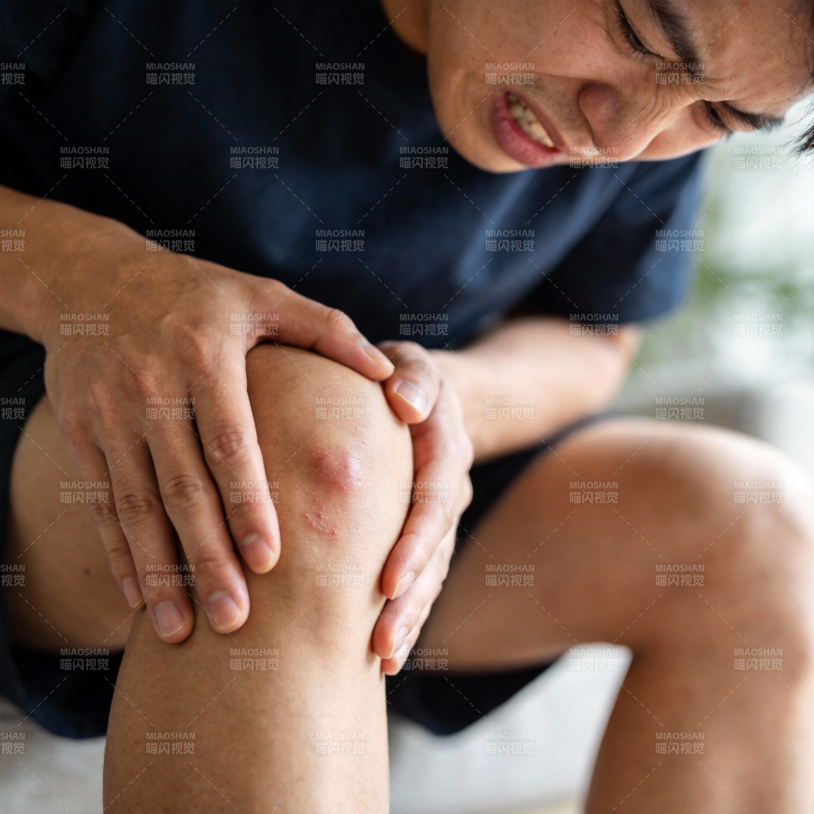 膝盖疼痛难忍图片