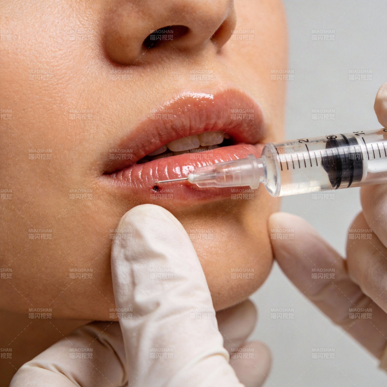 唇部注射美容图片