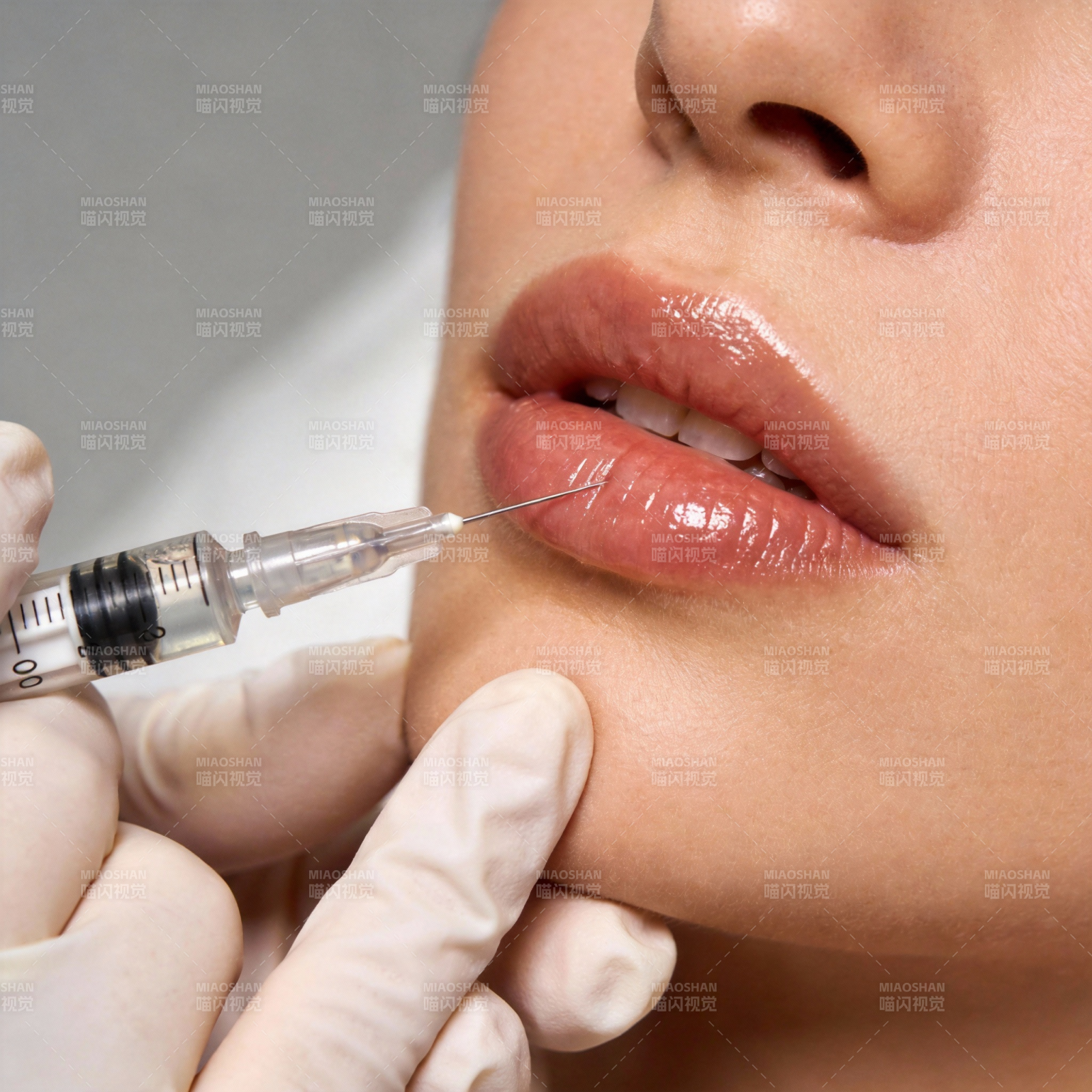唇部注射美容图片