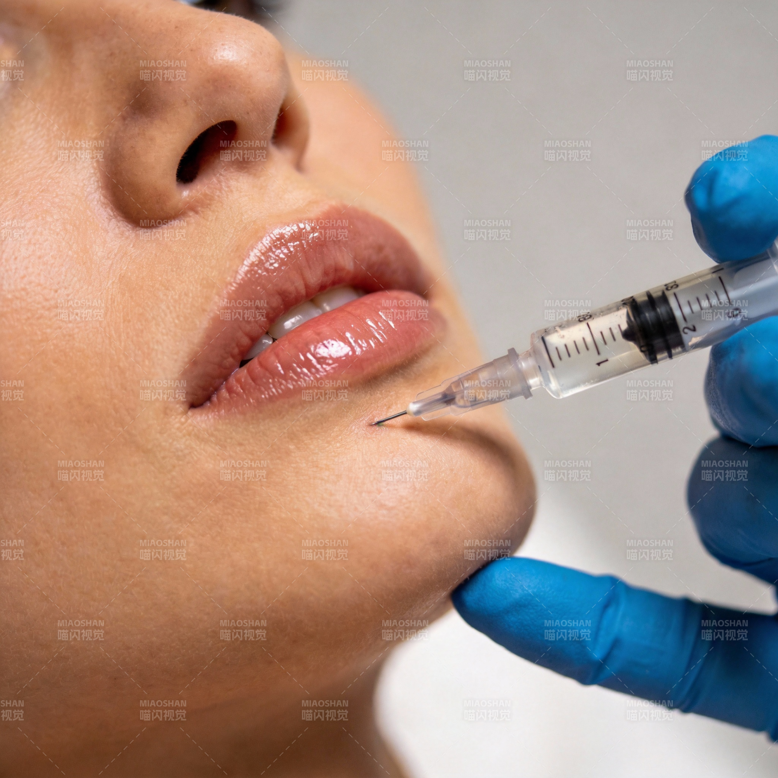 唇部注射美容图片