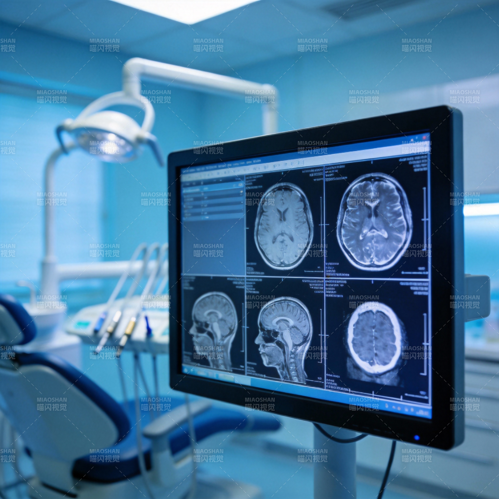 脑部MRI扫描影像图片